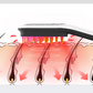 RegenComb™ : Scientifically Designed for Hair Restoration