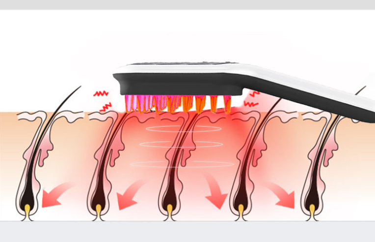 RegenComb™ : Scientifically Designed for Hair Restoration